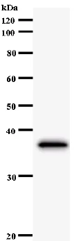 Western blot - Anti-CBLB antibody [246C5a] (AB54362)