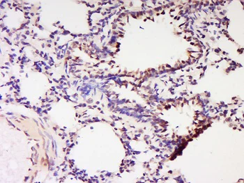 Immunohistochemistry (Formalin/PFA-fixed paraffin-embedded sections) - Anti-CBLB antibody (AB215991)