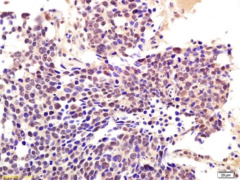Immunohistochemistry (Formalin/PFA-fixed paraffin-embedded sections) - Anti-CBLB antibody (AB215991)