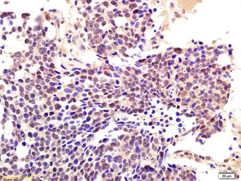 Immunohistochemistry (Formalin/PFA-fixed paraffin-embedded sections) - Anti-CBLB antibody (AB215991)