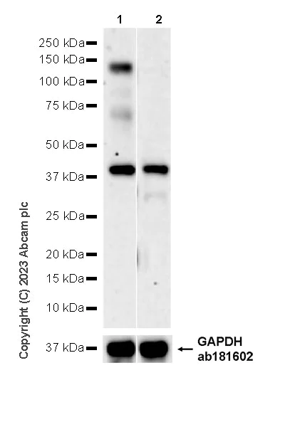 Western blot - Anti-CBLB antibody [EPR28082-32] - BSA and Azide free (AB315022)