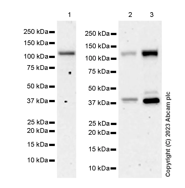 Western blot - Anti-CBLB antibody [EPR28082-32] - BSA and Azide free (AB315022)