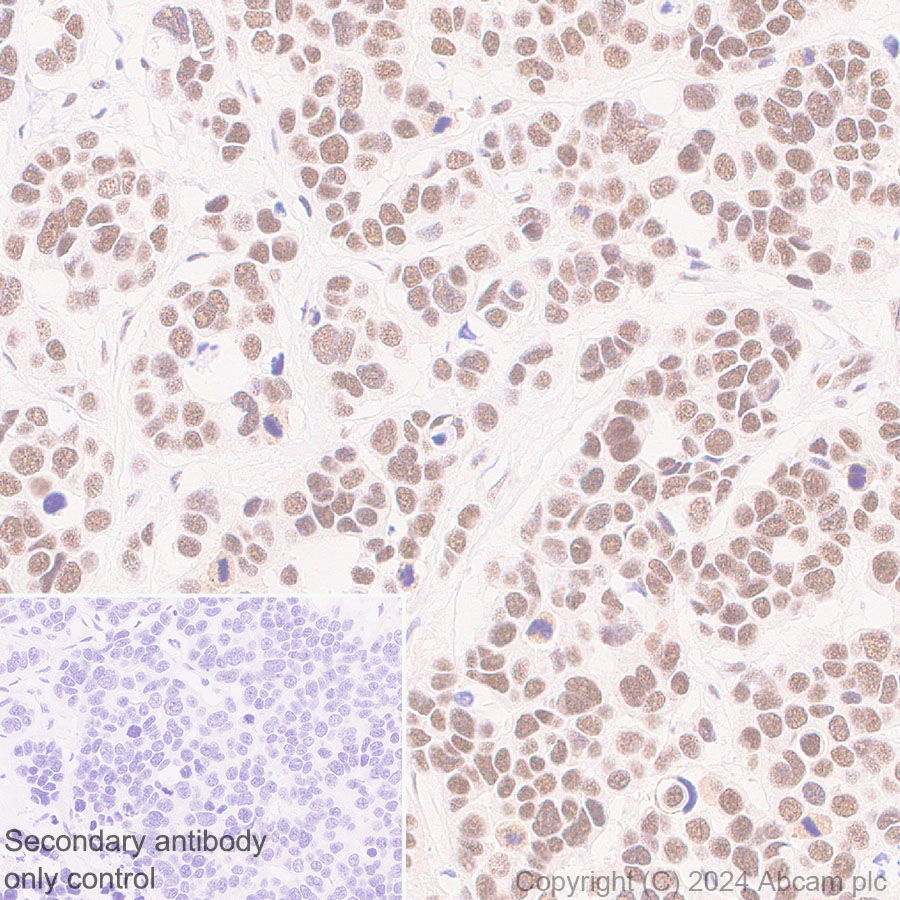 Immunohistochemistry (Formalin/PFA-fixed paraffin-embedded sections) - Anti-CBLL1 antibody [EPR25389-121] - BSA and Azide free (ab316307), expandable thumbnail