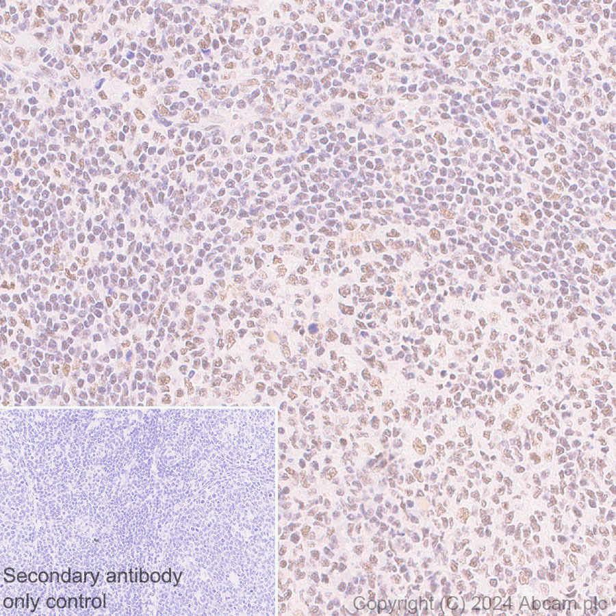 Immunohistochemistry (Formalin/PFA-fixed paraffin-embedded sections) - Anti-CBLL1 antibody [EPR25389-121] - BSA and Azide free (ab316307), expandable thumbnail