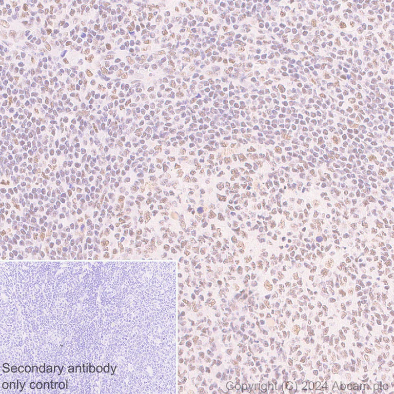 Immunohistochemistry (Formalin/PFA-fixed paraffin-embedded sections) - Anti-CBLL1 antibody [EPR25389-121] - BSA and Azide free (AB316307)