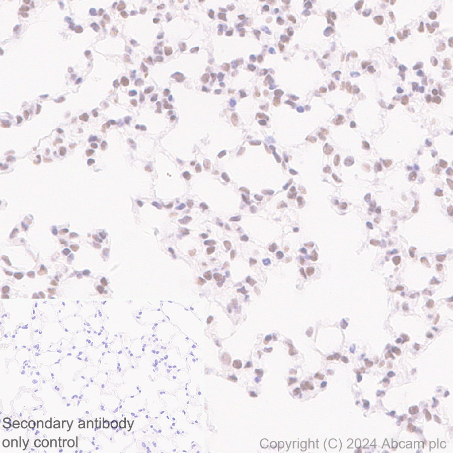Immunohistochemistry (Formalin/PFA-fixed paraffin-embedded sections) - Anti-CBLL1 antibody [EPR25389-121] - BSA and Azide free (ab316307), expandable thumbnail