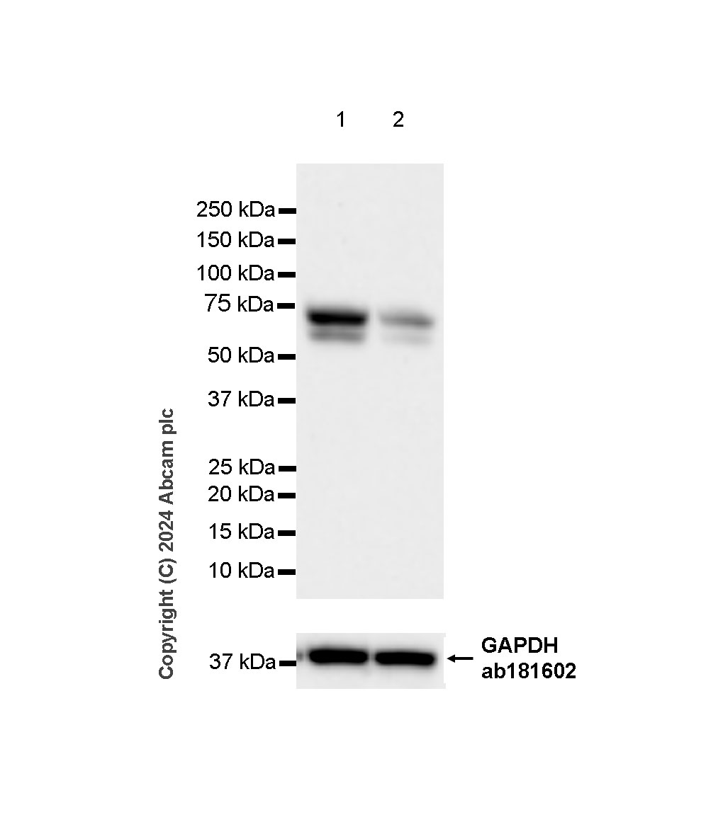 Western blot - Anti-CBLL1 antibody [EPR25389-121] - BSA and Azide free (AB316307), expandable thumbnail
