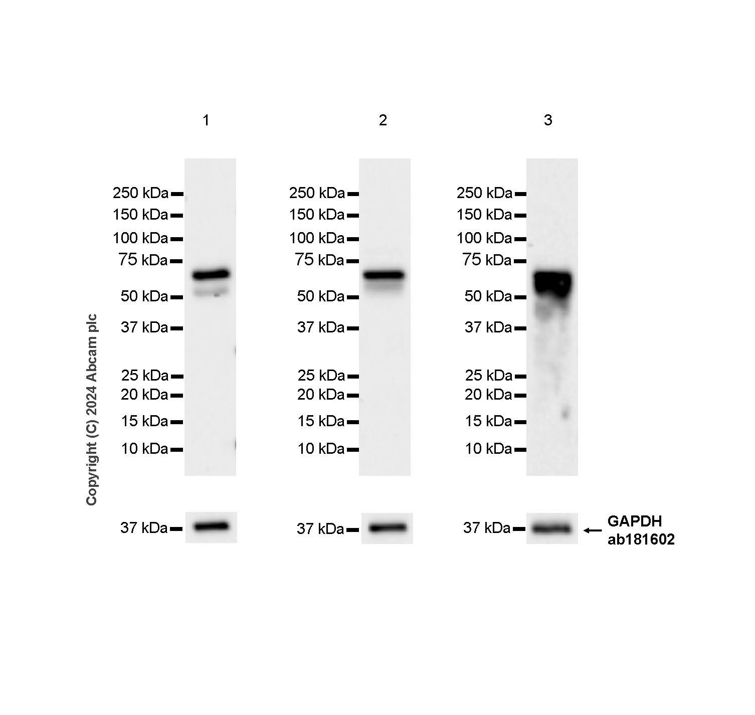 Western blot - Anti-CBLL1 antibody [EPR25389-121] - BSA and Azide free (AB316307), expandable thumbnail