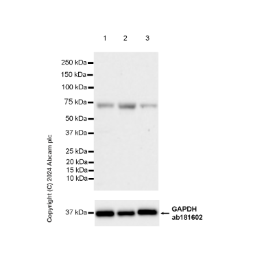 Western blot - Anti-CBLL1 antibody [EPR25389-121] - BSA and Azide free (AB316307), expandable thumbnail