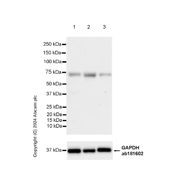 Western blot - Anti-CBLL1 antibody [EPR25389-121] - BSA and Azide free (AB316307)