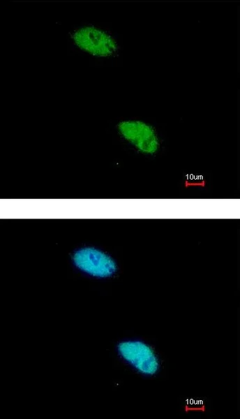 Immunocytochemistry/ Immunofluorescence - Anti-CBP80 antibody (AB154532)