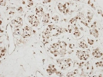 Immunohistochemistry (Formalin/PFA-fixed paraffin-embedded sections) - Anti-CBP80 antibody (AB154532)