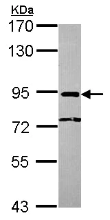 Western blot - Anti-CBP80 antibody (AB154532)