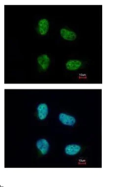 Immunocytochemistry/ Immunofluorescence - Anti-CBP80 antibody - N-terminal (AB228885)