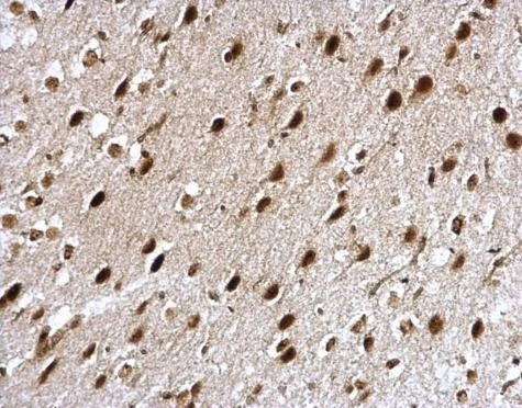 Immunohistochemistry (Formalin/PFA-fixed paraffin-embedded sections) - Anti-CBP80 antibody - N-terminal (AB228885)
