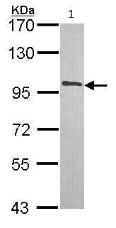 Western blot - Anti-CBP80 antibody - N-terminal (AB228885)