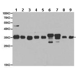 Western blot - Anti-CBR1 antibody (AB186825)