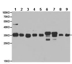 Western blot - Anti-CBR1 antibody (AB186825)
