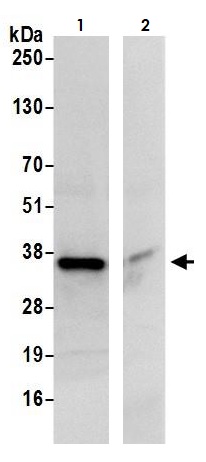 Immunoprecipitation - Anti-CBR1 antibody (AB264359), expandable thumbnail