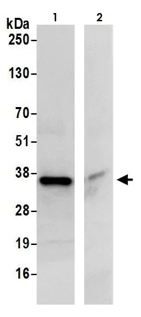 Immunoprecipitation - Anti-CBR1 antibody (AB264359)