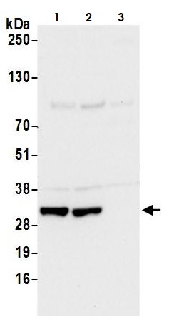 Western blot - Anti-CBR1 antibody (AB264359), expandable thumbnail