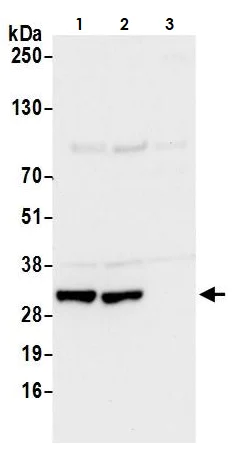 Western blot - Anti-CBR1 antibody (AB264359)