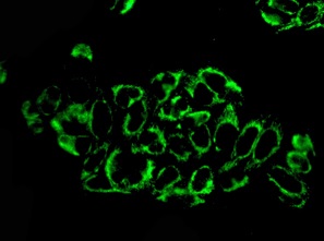 Immunocytochemistry/ Immunofluorescence - Anti-CBR1 antibody [EPR9660] (AB156590), expandable thumbnail