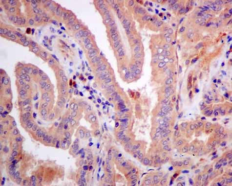 Immunohistochemistry (Formalin/PFA-fixed paraffin-embedded sections) - Anti-CBR1 antibody [EPR9660] (AB156590), expandable thumbnail