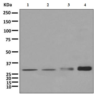Western blot - Anti-CBR1 antibody [EPR9660] (ab156590), expandable thumbnail