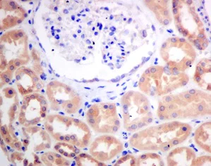 Immunohistochemistry (Formalin/PFA-fixed paraffin-embedded sections) - Anti-CBR1 antibody [EPR9660] - BSA and Azide free (AB249278)