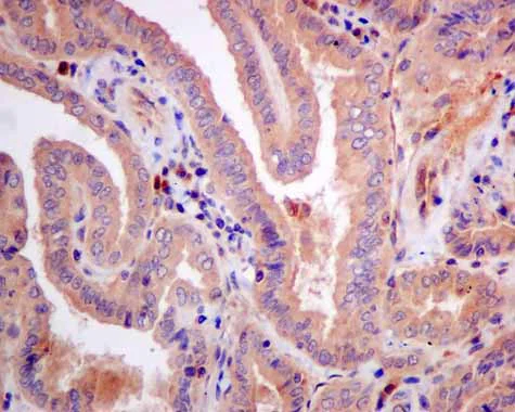 Immunohistochemistry (Formalin/PFA-fixed paraffin-embedded sections) - Anti-CBR1 antibody [EPR9660] - BSA and Azide free (AB249278)