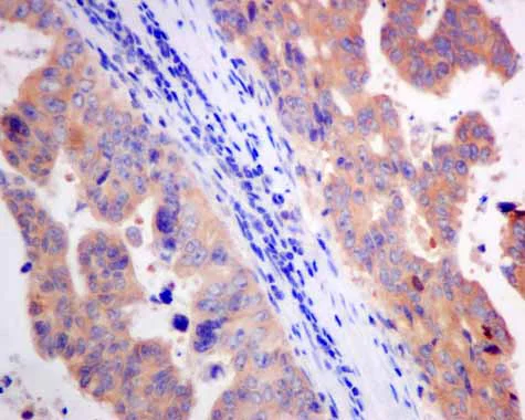 Immunohistochemistry (Formalin/PFA-fixed paraffin-embedded sections) - Anti-CBR1 antibody [EPR9660] - BSA and Azide free (AB249278)