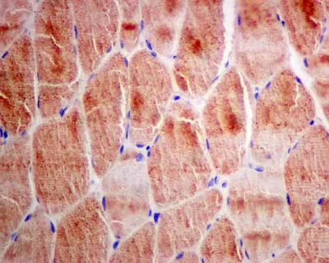 Immunohistochemistry (Formalin/PFA-fixed paraffin-embedded sections) - Anti-CBR1 antibody [EPR9660] - BSA and Azide free (AB249278)