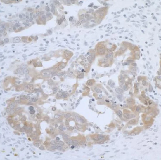 Immunohistochemistry (Formalin/PFA-fixed paraffin-embedded sections) - Anti-CBS antibody (AB226194)