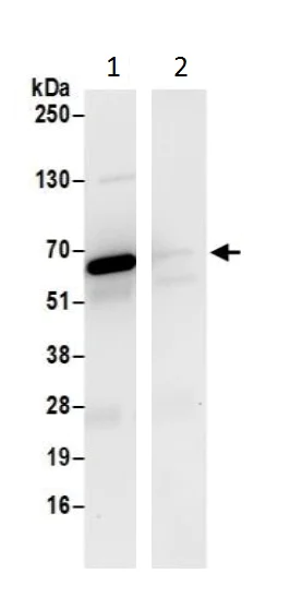 Immunoprecipitation - Anti-CBS antibody (AB226194)