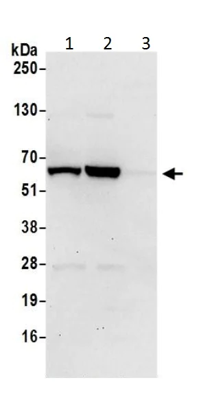 Western blot - Anti-CBS antibody (AB226194)