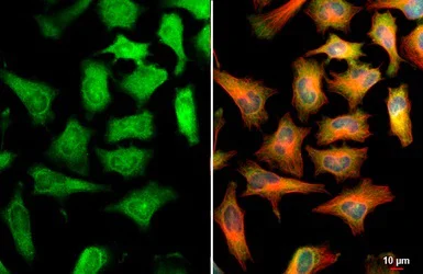 Immunocytochemistry/ Immunofluorescence - Anti-CBS antibody (AB96252)