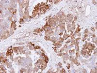 Immunohistochemistry (Formalin/PFA-fixed paraffin-embedded sections) - Anti-CBS antibody (AB96252)