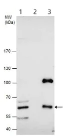 Immunoprecipitation - Anti-CBS antibody (AB96252)