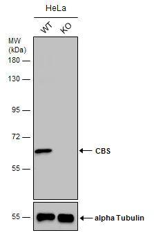 Western blot - Anti-CBS antibody (AB96252)
