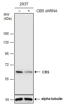 Western blot - Anti-CBS antibody (AB96252)