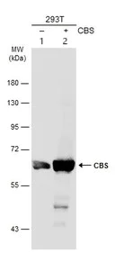Western blot - Anti-CBS antibody (AB96252)