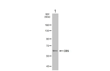 Western blot - Anti-CBS antibody (AB96252)