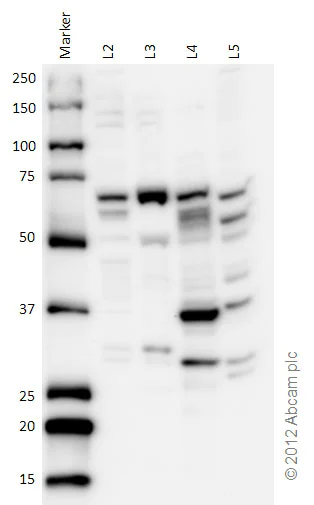Western blot - Anti-CBS antibody (AB96252)