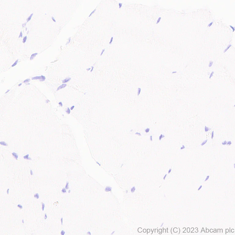 Immunohistochemistry (Formalin/PFA-fixed paraffin-embedded sections) - Anti-CBS antibody [EPR28083-45] - BSA and Azide free (AB313383)