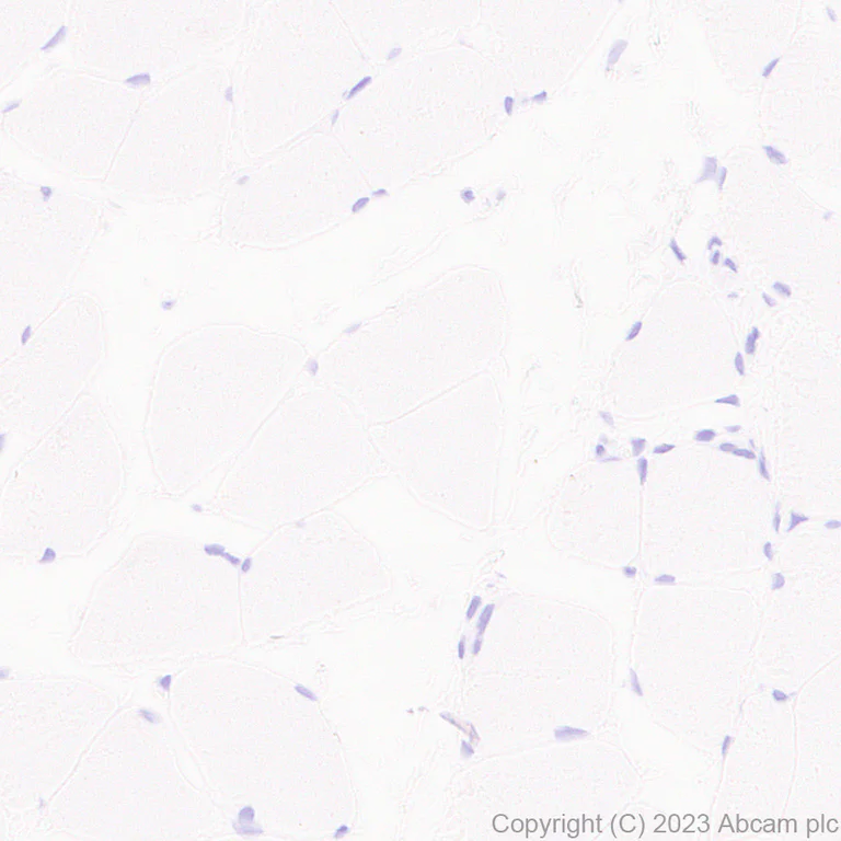 Immunohistochemistry (Formalin/PFA-fixed paraffin-embedded sections) - Anti-CBS antibody [EPR28083-45] - BSA and Azide free (AB313383)