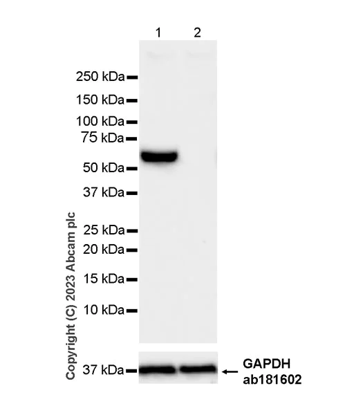 Western blot - Anti-CBS antibody [EPR28083-45] - BSA and Azide free (AB313383)