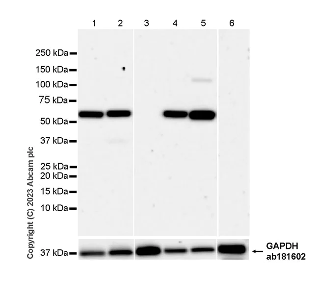 Western blot - Anti-CBS antibody [EPR28083-45] - BSA and Azide free (AB313383)