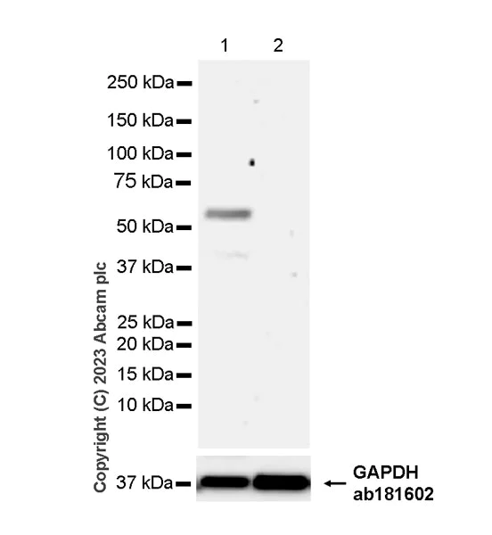 Western blot - Anti-CBS antibody [EPR28083-45] - BSA and Azide free (AB313383)