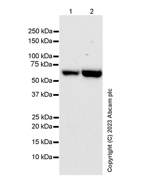Western blot - Anti-CBS antibody [EPR28083-45] - BSA and Azide free (AB313383)